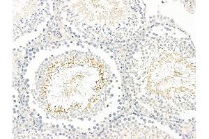 anti-B Melanoma Antigen Family, Member 2 (BAGE2) (Internal Region) antibody