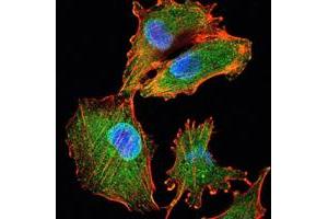 .Immunofluorescence analysis of U251 cells using IL34 mouse mAb (green). Blue. DRAQ5 fluorescent DNA dye. Red. Actin filaments have been labeled with Alexa Fluor-555 phalloidin. (IL-34 antibody)