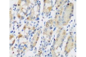 Immunohistochemistry of paraffin-embedded Human stomach using RRM1 Polyclonal Antibody at dilution of 1:200 (40x lens). (RRM1 antibody)