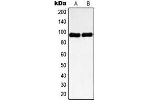 Western blot analysis of Nibrin expression in HeLa (A), HL60 (B) whole cell lysates. (Nibrin antibody  (Center))