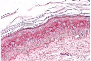 Human Skin: Formalin-Fixed, Paraffin-Embedded (FFPE) (GM2A antibody  (C-Term))