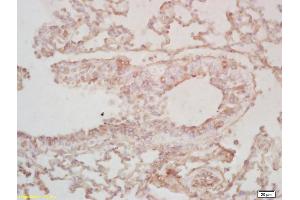 Formalin-fixed and paraffin embedded mouse lung labeled with Rabbit Anti BCAS2 Polyclonal Antibody, Unconjugated (ABIN718811) at 1:200 followed by conjugation to the secondary antibody and DAB staining (BCAS2 antibody  (AA 151-225))