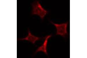 ABIN6274040 staining HepG2 by IF/ICC. (PRC1 antibody  (Internal Region))