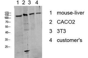 Western Blot analysis of various cells using Phospho-DDR1 (Tyr513) Polyclonal Antibody at dilution of 1:1000. (DDR1 antibody  (pTyr513))