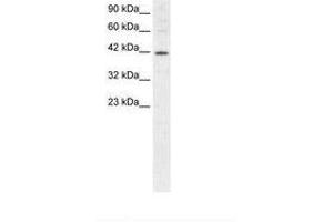 Image no. 1 for anti-Mesoderm Induction Early Response 1 (MIER1) (AA 250-293) antibody (ABIN202515) (MIER1 antibody  (AA 250-293))