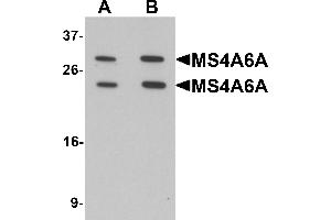 Western blot analysis of MS4A6A in 293 cell lysate with MS4A6A antibody at (A) 1 and (B) 2 µg/mL.