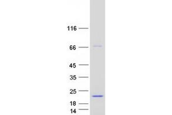 SPRED3 Protein (Transcript Variant 2) (Myc-DYKDDDDK Tag)