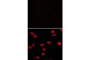 Immunofluorescence analysis of SET07 antibody and HeLa cells with (bottom) and without (top) PE-conjugated goat anti-mouse lgG secondary. (SETD8 antibody  (N-Term))