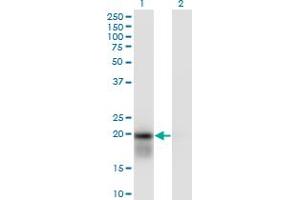 Western Blot analysis of UBE2H expression in transfected 293T cell line by UBE2H monoclonal antibody (M01), clone 3C4-1A2.