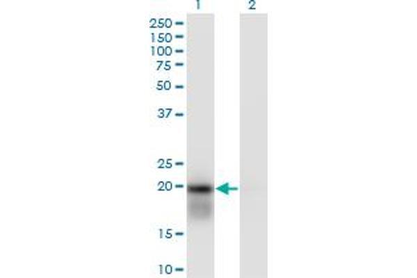 UBE2H Antikörper  (AA 1-183)