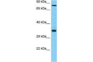 Host:  Rabbit  Target Name:  MGAT5  Sample Type:  OVCAR-3 Whole Cell lysates  Antibody Dilution:  1. (MGAT5 antibody  (C-Term))
