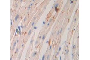 IHC-P analysis of Kidney tissue, with DAB staining. (ADCY9 antibody  (AA 852-1065))
