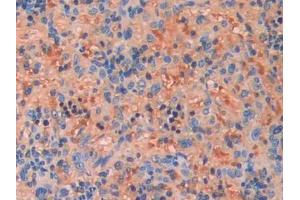 DAB staining on IHC-P; Samples: Rat Spleen Tissue (FGF13 antibody  (AA 1-192))