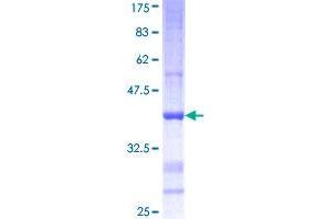 AMY2B Protein (AA 19-117) (GST tag)