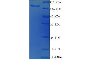 SDS-PAGE (SDS) image for SWI/SNF Related, Matrix Associated, Actin Dependent Regulator of Chromatin, Subfamily A, Member 2 (SMARCA2) (AA 700-1216), (partial) protein (His-SUMO Tag) (ABIN5710378) (SMARCA2 Protein (AA 700-1216, partial) (His-SUMO Tag))