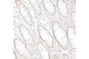 Immunohistochemistry (IHC) image for anti-Poly (ADP-Ribose) Polymerase Family, Member 10 (PARP10) (AA 300-350) antibody (ABIN7454656)