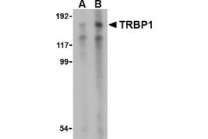 Western blot analysis of TRBP1 in 3T3 cell lysate with TRBP1 antibody at (A) 1 and (B) 2 µg/mL. (TARBP2 antibody  (Middle Region))