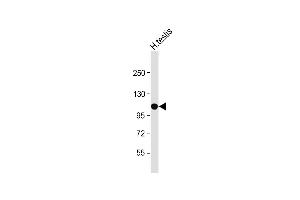 Anti-SLC14A2 Antibody (N-Term) at 1:500 dilution + Human testis lysate Lysates/proteins at 20 μg per lane.