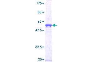 Image no. 1 for Amino-terminal Enhancer of Split (AES) (AA 1-264) protein (GST tag) (ABIN1344513) (AES Protein (AA 1-264) (GST tag))