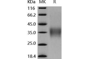 Western Blotting (WB) image for Low Affinity Immunoglobulin gamma Fc Region Receptor IV (FCGR4) (Active) protein (His tag,AVI tag) (ABIN7196849) (Low Affinity Immunoglobulin gamma Fc Region Receptor IV (FCGR4) (Active) protein (His tag,AVI tag))
