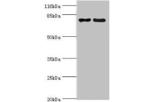 Western blot All lanes: MTRR antibody at 2 μg/mL Lane 1: PC-3 whole cell lysate Lane 2: HepG2 whole cell lysate Secondary Goat polyclonal to rabbit IgG at 1/10000 dilution Predicted band size: 81, 78, 7 kDa Observed band size: 81 kDa