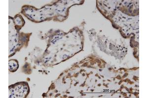 Immunoperoxidase of monoclonal antibody to C6orf199 on formalin-fixed paraffin-embedded human placenta. (AKD1 antibody  (AA 321-421))