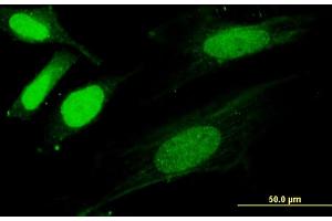 Immunofluorescence of monoclonal antibody to SNX20 on HeLa cell. (SNX20 antibody  (AA 47-128))