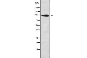 Western blot analysis of ESCO1 using COLO205 whole cell lysates (ESCO1 antibody  (Internal Region))