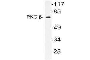 Western blot (WB) analysis of PKC beta antibody in extracts from HeLa cells (PKC beta antibody)