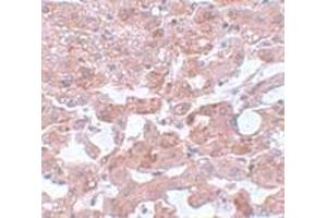 Immunohistochemistry (IHC) image for anti-Cell Division Cycle 16 Homolog (S. Cerevisiae) (CDC16) (N-Term) antibody (ABIN1031232)