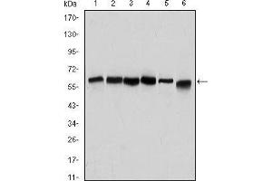 Western blot analysis using BECN1 mouse mAb against Hela (1), A431 (2), MCF-7 (3), RAJI (4), Jurkat (5) and SKBR-3 (6) cell lysate.