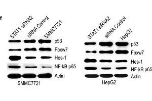 Western Blotting (WB) image for anti-Tumor Protein P53 (TP53) (AA 301-393) antibody (ABIN677408)