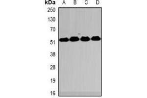 Western blot analysis of MeCP2 expression in HT29 (A), Jurkat (B), mouse spleen (C), mouse lung (D) whole cell lysates. (MECP2 antibody)