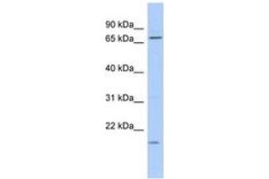 Image no. 1 for anti-Far Upstream Element (FUSE) Binding Protein 3 (FUBP3) (AA 35-84) antibody (ABIN6743586) (FUBP3 antibody  (AA 35-84))