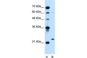 Western Blotting (WB) image for anti-Immunoglobulin lambda-Like Polypeptide 1 (IGLL1) antibody (ABIN2462601) (IGLL1 antibody)