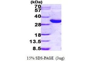 SDS-PAGE (SDS) image for Hydroxysteroid (17-Beta) Dehydrogenase 14 (HSD17B14) (AA 1-270) protein (His tag) (ABIN667275)