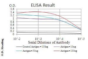 Black line: Control Antigen (100 ng), Purple line: Antigen(10 ng), Blue line: Antigen (50 ng), Red line: Antigen (100 ng), (IRAK3 antibody  (AA 454-596))