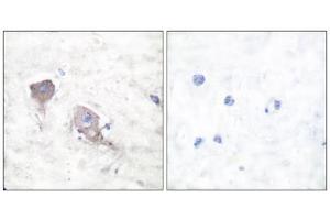 Immunohistochemical analysis of paraffin-embedded human brain tissue using SNAP25 antibody (ABIN5976506). (SNAP25 antibody  (C-Term))