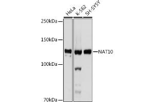 NAT10 antibody