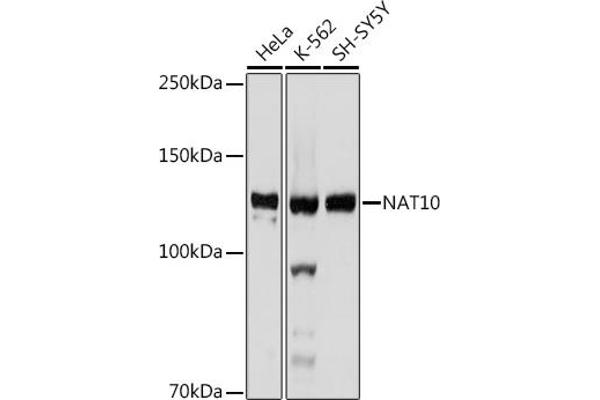 NAT10 antibody