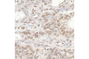 Immunohistochemistry (IHC) image for anti-General Transcription Factor IIIC, Polypeptide 5 (GTF3C5) (AA 469-519) antibody (ABIN7454732) (GTF3C5 antibody  (AA 469-519))
