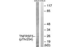Western blot analysis of extracts from COLO205 cells treated with Insulin 0. (CD40 antibody  (pThr254))
