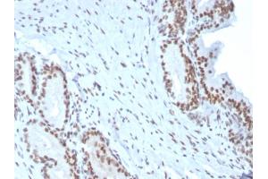 Immunohistochemistry (IHC) image for anti-BMI1 Polycomb Ring Finger Oncogene (BMI1) (AA 142-326) antibody (ABIN6940582)