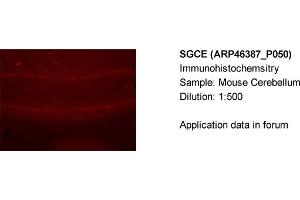 Immunohistochemistry (IHC) image for anti-Sarcoglycan, epsilon (SGCE) (N-Term) antibody (ABIN2782610)