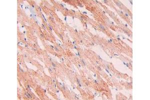 Used in DAB staining on fromalin fixed paraffin- embedded heart tissue (SNCAIP antibody  (AA 766-963))