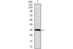 Western blot analysis using LPA mAb against human LPA recombinant protein. (LPA antibody  (AA 4330-4521))