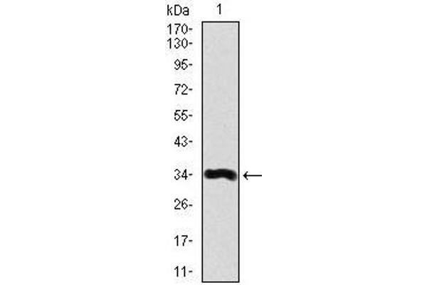 LPA 抗体  (AA 4330-4521)