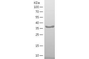 Western Blotting (WB) image for Ribosomal Protein S3 (RPS3) (AA 70-200) protein (His-IF2DI Tag) (ABIN7282767) (RPS3 Protein (AA 70-200) (His-IF2DI Tag))