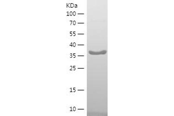 RPS3 Protein (AA 70-200) (His-IF2DI Tag)