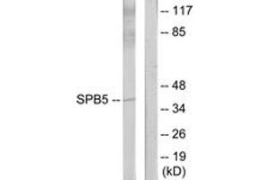 Western blot analysis of extracts from HeLa cells, using Serpin B5 Antibody. (SERPINB5 antibody  (AA 91-140))